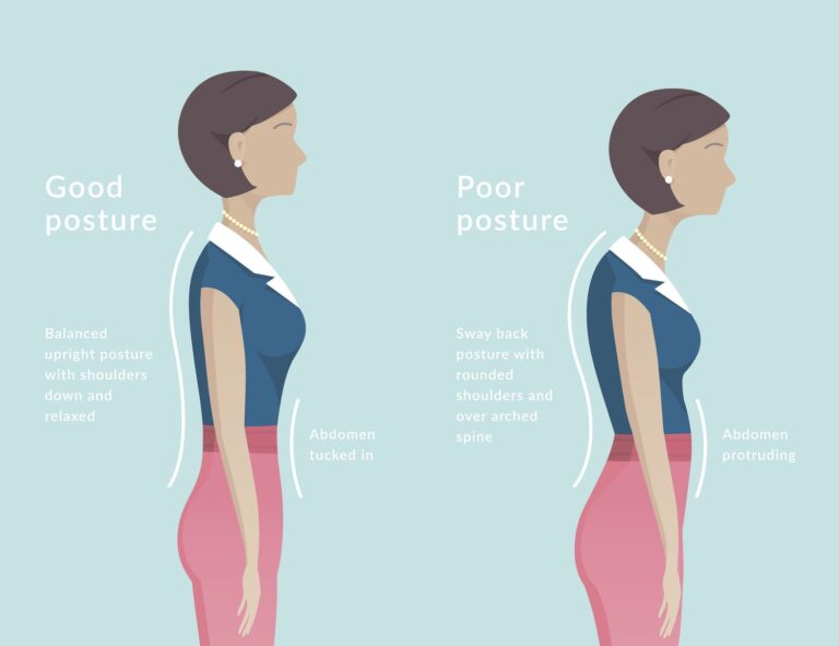 woman with Poor posture illustration, by Getty Images